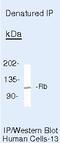 RB Transcriptional Corepressor 1 antibody, MA5-11387, Invitrogen Antibodies, Immunoprecipitation image 