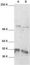 Nuclear Factor Kappa B Subunit 1 antibody, MBS440032, MyBioSource, Western Blot image 