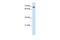 TATA-Box Binding Protein Associated Factor 6 antibody, PA5-40955, Invitrogen Antibodies, Western Blot image 