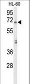 Amylase Alpha 1C (Salivary) antibody, LS-C156318, Lifespan Biosciences, Western Blot image 