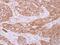 Tyrosine 3-Monooxygenase/Tryptophan 5-Monooxygenase Activation Protein Theta antibody, PA5-27641, Invitrogen Antibodies, Immunohistochemistry frozen image 