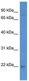 PYM1 antibody, TA342978, Origene, Western Blot image 