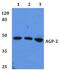 Orosomucoid 2 antibody, A04684, Boster Biological Technology, Western Blot image 