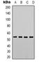 Phosphatase And Tensin Homolog antibody, orb318759, Biorbyt, Western Blot image 