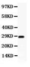 Synaptonemal Complex Protein 3 antibody, RP1035, Boster Biological Technology, Western Blot image 
