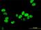 X-Ray Repair Cross Complementing 5 antibody, H00007520-M02, Novus Biologicals, Immunocytochemistry image 