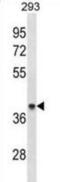 Acetyl-CoA Acyltransferase 1 antibody, abx031283, Abbexa, Western Blot image 