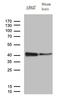 Regulator Of Calcineurin 1 antibody, LS-C792480, Lifespan Biosciences, Western Blot image 