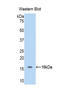 Hemoglobin Subunit Alpha 2 antibody, LS-C294447, Lifespan Biosciences, Western Blot image 