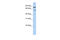 Twinkle protein, mitochondrial antibody, ARP36483_P050, Aviva Systems Biology, Western Blot image 