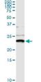 NME/NM23 Nucleoside Diphosphate Kinase 1 antibody, H00004830-M02, Novus Biologicals, Immunoprecipitation image 