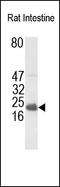 S100 Calcium Binding Protein B antibody, 251795, Abbiotec, Western Blot image 