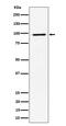 Ribosomal Protein S6 Kinase A3 antibody, M02215-1, Boster Biological Technology, Western Blot image 