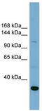 Sodium/hydrogen exchanger 1 antibody, TA334046, Origene, Western Blot image 