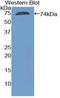 Actin Gamma 1 antibody, LS-C420427, Lifespan Biosciences, Western Blot image 