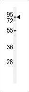 Pyridoxal Dependent Decarboxylase Domain Containing 1 antibody, 61-727, ProSci, Western Blot image 