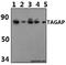 T Cell Activation RhoGTPase Activating Protein antibody, A09403-1, Boster Biological Technology, Western Blot image 