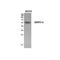 Bone Morphogenetic Protein Receptor Type 1A antibody, STJ96893, St John