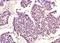Cyclin Dependent Kinase 1 antibody, orb5823, Biorbyt, Immunohistochemistry paraffin image 