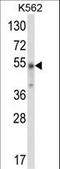 WD repeat, SAM and U-box domain-containing protein 1 antibody, LS-C160613, Lifespan Biosciences, Western Blot image 