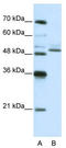 Zinc Finger Protein 296 antibody, TA345523, Origene, Western Blot image 
