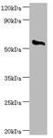 Cholesterol side-chain cleavage enzyme, mitochondrial antibody, A55579-100, Epigentek, Western Blot image 