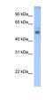 STEAP3 Metalloreductase antibody, orb330304, Biorbyt, Western Blot image 