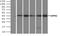 Death Associated Protein Kinase 2 antibody, NBP2-02477, Novus Biologicals, Immunoprecipitation image 