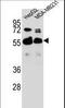 Rap1 GTPase-GDP Dissociation Stimulator 1 antibody, LS-C162439, Lifespan Biosciences, Western Blot image 