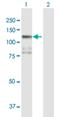 Serine/Threonine Kinase 31 antibody, H00056164-B01P, Novus Biologicals, Western Blot image 