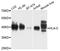 HLA class I histocompatibility antigen, Cw-3 alpha chain antibody, A1013, ABclonal Technology, Western Blot image 
