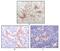 FES Proto-Oncogene, Tyrosine Kinase antibody, MA5-15351, Invitrogen Antibodies, Immunohistochemistry paraffin image 