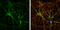 Microtubule Associated Protein 1B antibody, GTX133209, GeneTex, Immunofluorescence image 
