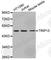 Thyroid Hormone Receptor Interactor 13 antibody, A3352, ABclonal Technology, Western Blot image 
