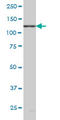 EPH Receptor B6 antibody, LS-B5403, Lifespan Biosciences, Western Blot image 