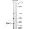 Mitochondrial Ribosomal Protein L13 antibody, A13508, Boster Biological Technology, Western Blot image 