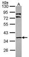 LIM Zinc Finger Domain Containing 1 antibody, PA5-30240, Invitrogen Antibodies, Western Blot image 