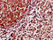 SLP Adaptor And CSK Interacting Membrane Protein antibody, LS-C681255, Lifespan Biosciences, Immunohistochemistry paraffin image 
