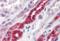 Golgi Associated, Gamma Adaptin Ear Containing, ARF Binding Protein 3 antibody, orb19126, Biorbyt, Immunohistochemistry paraffin image 
