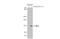 iNOS antibody, GTX636531, GeneTex, Western Blot image 