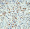 Cyclin E1 antibody, LS-C88539, Lifespan Biosciences, Immunohistochemistry paraffin image 