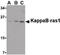 NFKB Inhibitor Interacting Ras Like 1 antibody, LS-C19461, Lifespan Biosciences, Western Blot image 