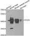 Sarcoglycan Beta antibody, A6979, ABclonal Technology, Western Blot image 