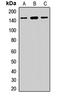 Desmoglein 2 antibody, LS-C667761, Lifespan Biosciences, Western Blot image 