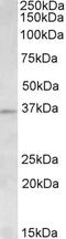 Aurora Kinase C antibody, EB09829, Everest Biotech, Western Blot image 