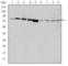 G Protein-Coupled Receptor Kinase 2 antibody, abx011687, Abbexa, Western Blot image 