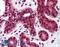 Tumor Protein P73 antibody, LS-B2084, Lifespan Biosciences, Immunohistochemistry paraffin image 