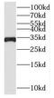 Solute Carrier Family 25 Member 15 antibody, FNab07931, FineTest, Western Blot image 