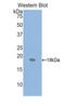 Parathyroid Hormone Like Hormone antibody, LS-C295766, Lifespan Biosciences, Western Blot image 