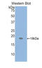 PTHRP antibody, LS-C295766, Lifespan Biosciences, Western Blot image 